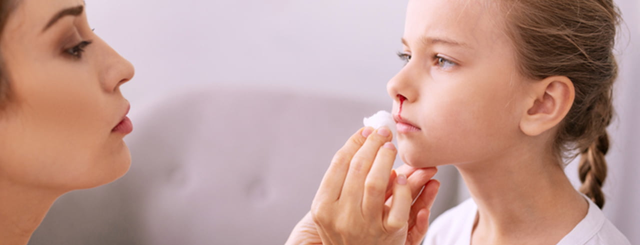 Tipps gegen das Nasenbluten